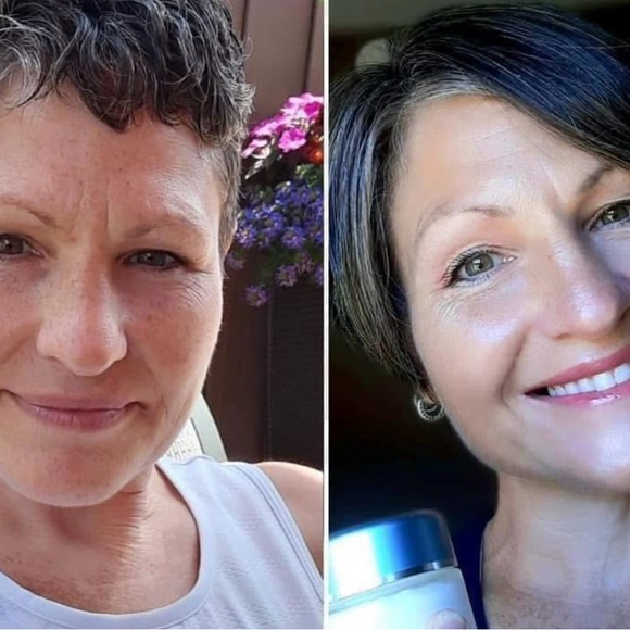 ageLOC Tru Face Uplifting Rich Cream - Picture 2 of 4